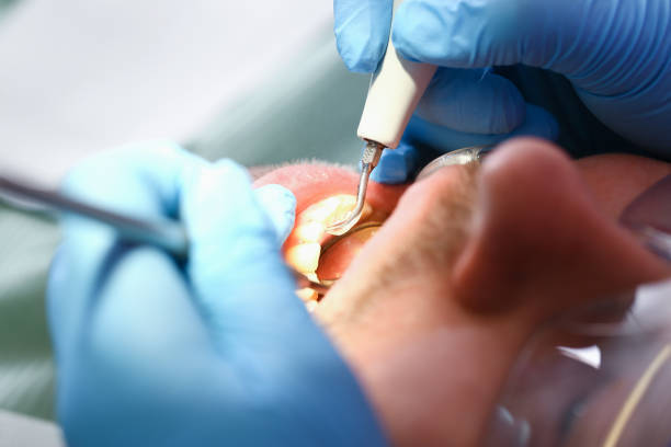 Best Emergency Gum Pain Relief  in Perry Heights, OH