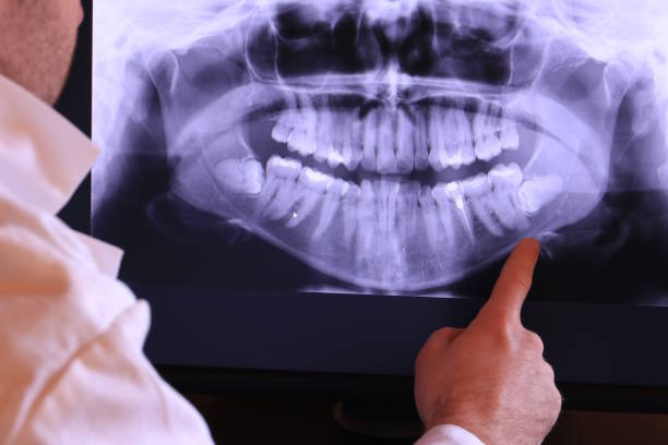 Best Emergency Tooth Extraction  in Perry Heights, OH